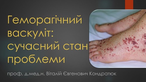 Відіотека.