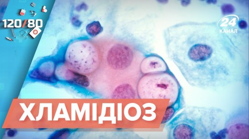 Відіотека.
